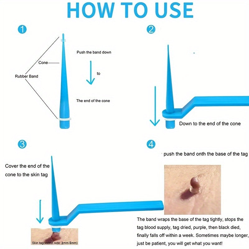 10 Stück \ u002FSet Skin Tag Kill Skin Mole Wart Entferner, Micro Skin Tag Entfernungs kit mit Reinigungs tupfer, Adult Mole Wart Gesichts pflege werkzeuge