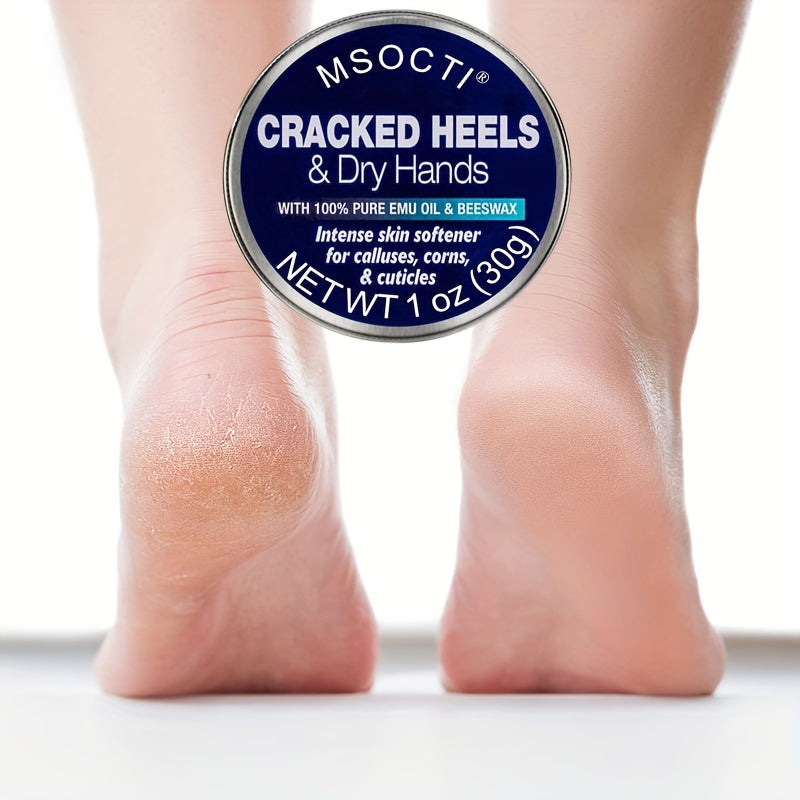 30g Cracked Heels & Dry Hands Intense Skin Softener -for Calluses, Corns Cuticle,Fast- Penetrating Hydrating Moisturizer, Made W\u002F 100% Pure Emu Oil & Beeswax,Foot Cream