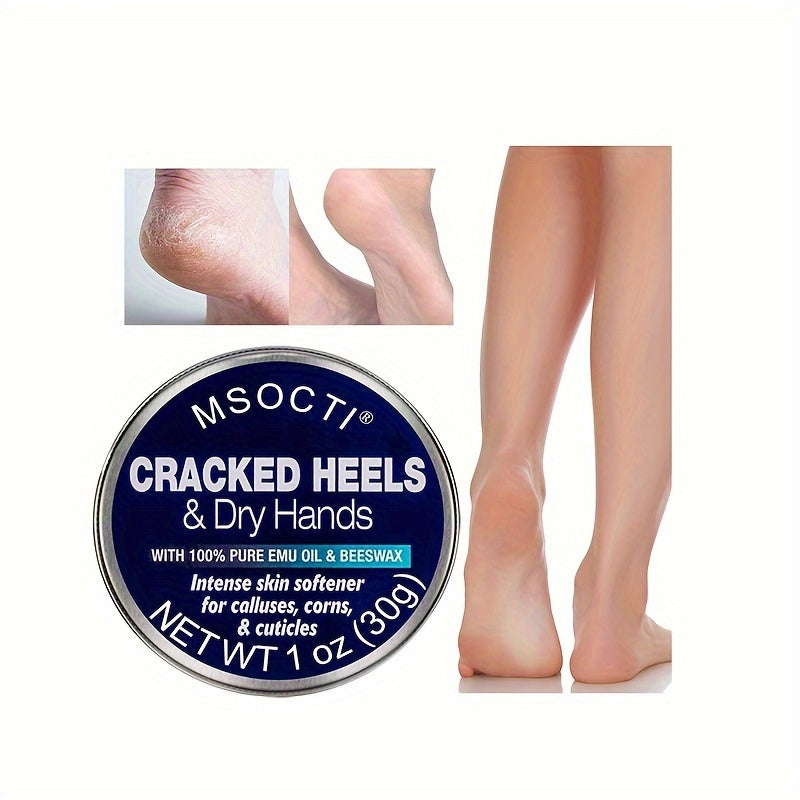 30g Cracked Heels & Dry Hands Intense Skin Softener -for Calluses, Corns Cuticle,Fast- Penetrating Hydrating Moisturizer, Made W\u002F 100% Pure Emu Oil & Beeswax,Foot Cream