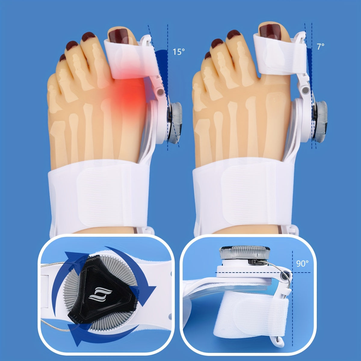 Non-Surgical Bunion & Toe Valgus Correction - Separate Toe, Correct Hammer Toe - Home\u002FNight Use Only, Replcement Required!