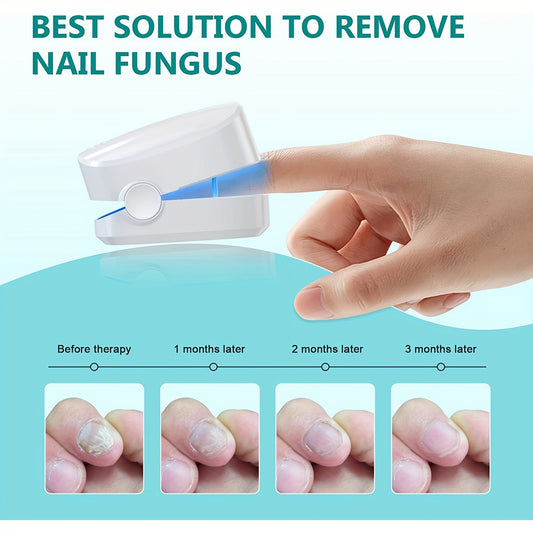Portable Rechargeable Nail Phototherapy Device